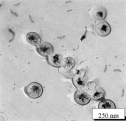 Abb. 5 beschichtete Nanopartikel (Quelle: Bechthold, 2000)