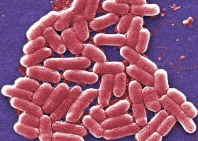 CleanroomNet: Bakterien Escherichia coli