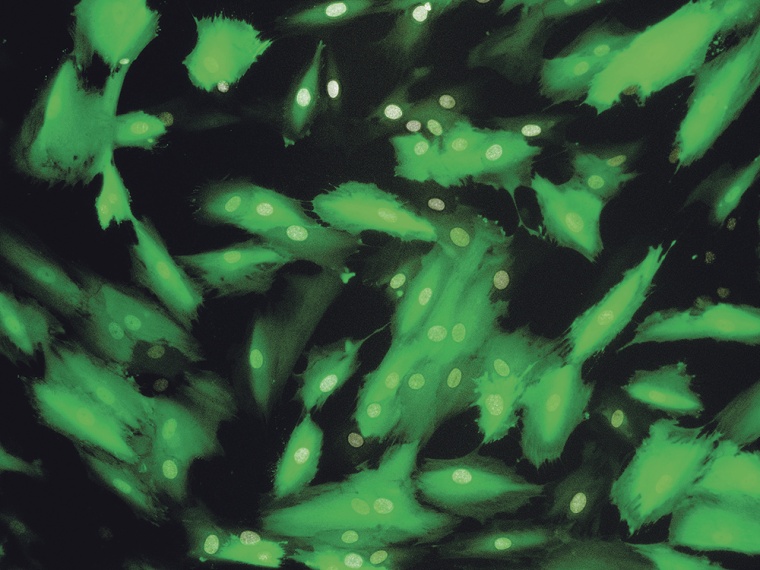 Mikroskopische Aufnahme der sog. Human Taste Cells. Diese Zellen können als...