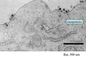 This electron micrograph shows the presence of numerous siRNA-containing...