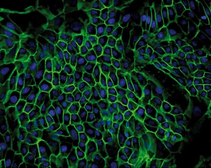 Fig. 2: Example of functional test. MDCK, canine epithelial cell line expresses...