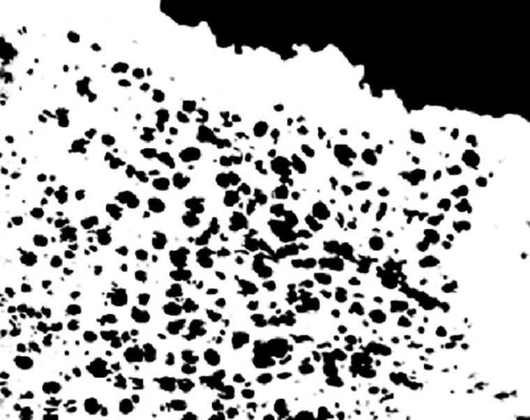 binary image after application of the threshold filter; © Strelen GmbH