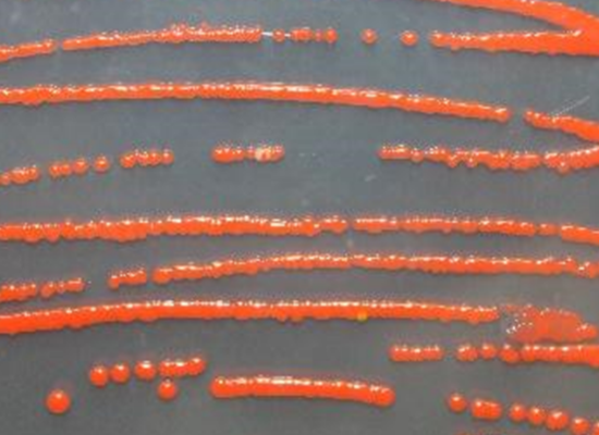 Colour-producing bacteria on a plate. © Capucine Vanbuis