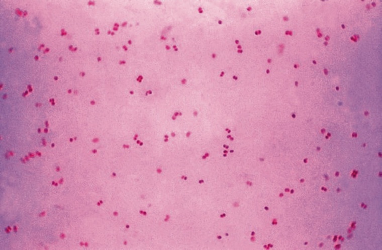 Neisseria gonorrhoeae, besser als „Tripper“ bekannt (© wikipedia.org)