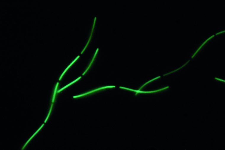 Methanospirillum sp. ist unter dem Mikroskop leicht an der Eigenfluoreszenz zu...