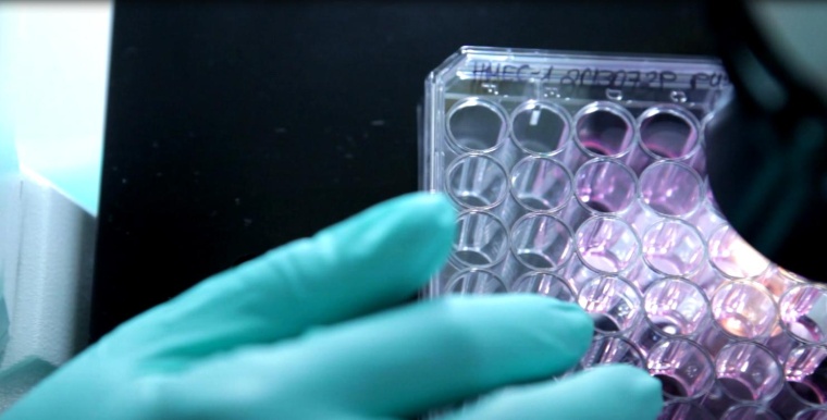 Sirion Biotech has signed a license and collaboration deal with Sanofi on viral...