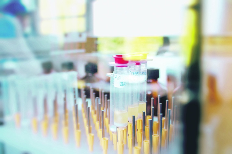 Belyntic’s Peptide Easy Clean (PEC) technology relies on a proprietary single...
