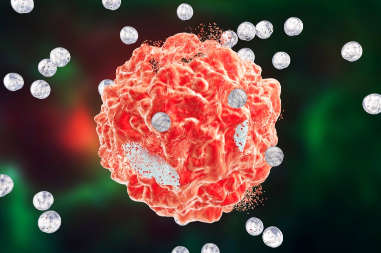 © KATERYNA KON/SCIENCE PHOTO LIBRARY/Getty Images