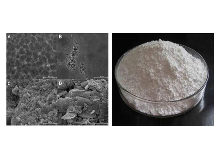 Fig: 3: (Left) – A-D: Various Scanning electron microscopy images with...