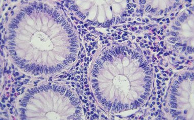 Sustainability in Bioprocessing